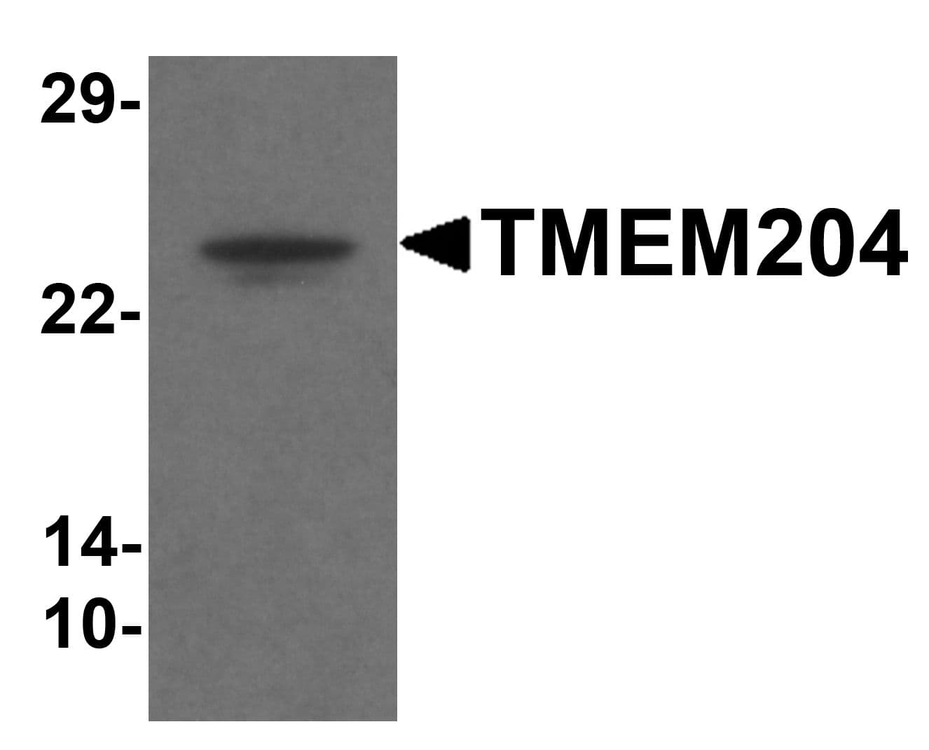 IHC-plus™ TMEM204 Antibody