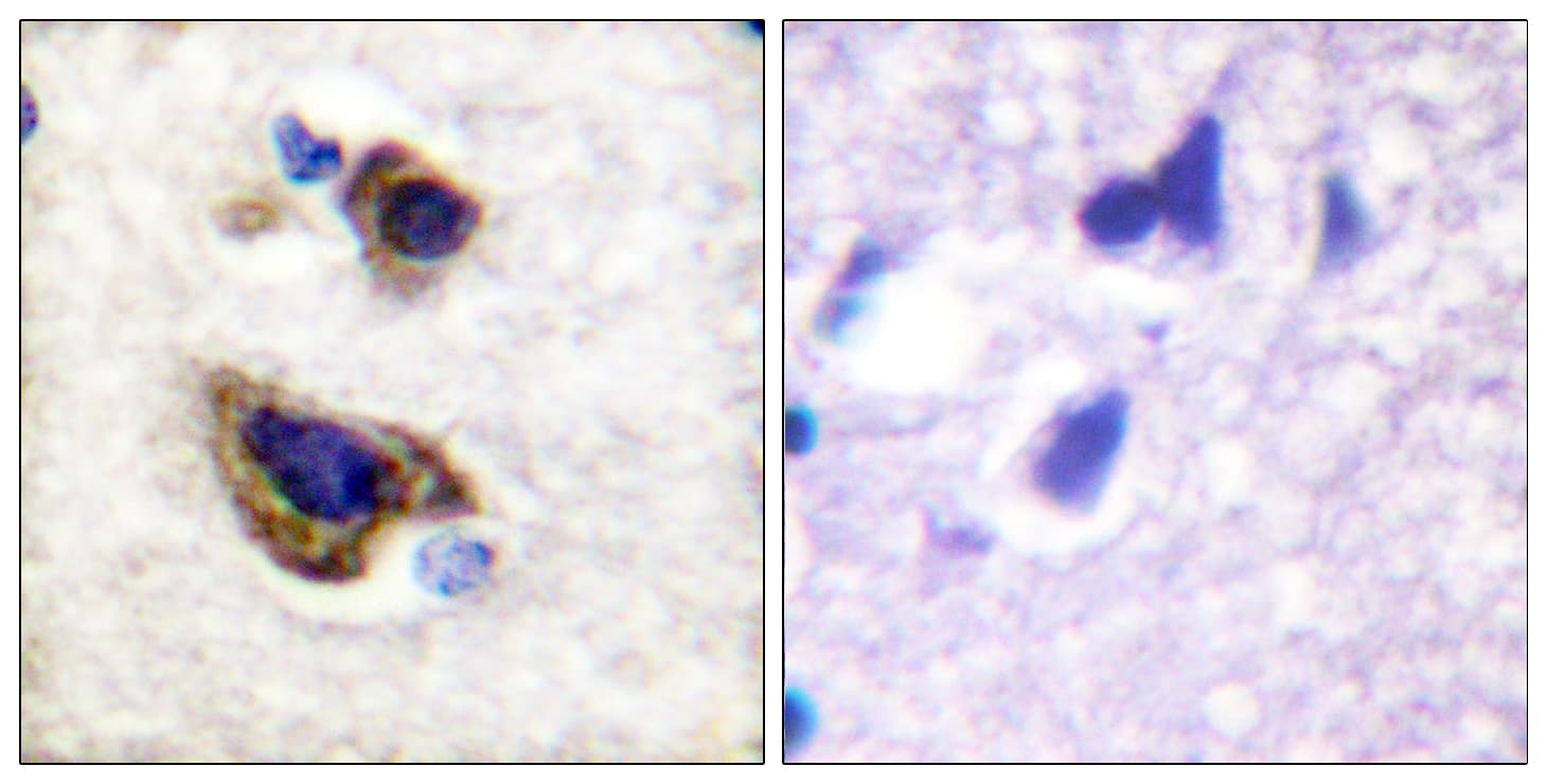 GFAP Antibody (aa11-60)