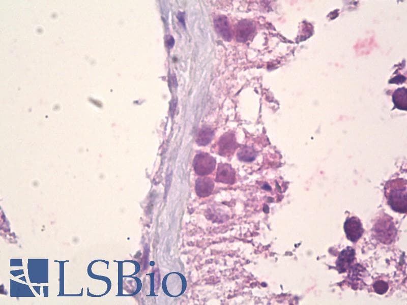 IHC-plus™ EFNA5 / Ephrin A5 Antibody (aa31-80)