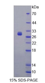 Mouse FBS1 Protein (Recombinant His-T7, N-terminus)