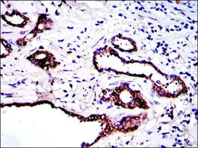 PKN2 Antibody (clone 1D1)