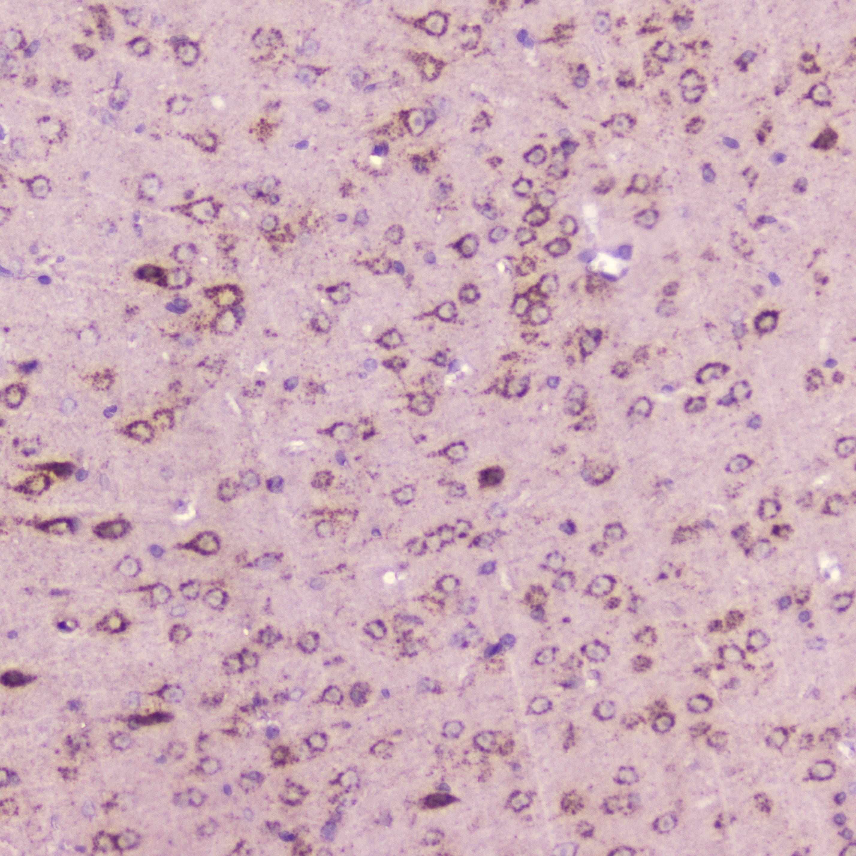 Polyclonal Rabbit anti-Mouse CALCA Antibody (IHC)
