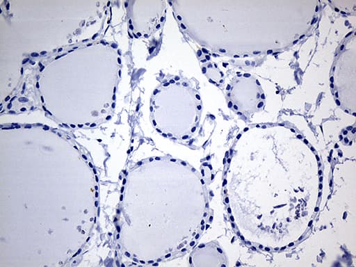 CYTH4 / PSCD4 Antibody (clone OTI4A5)