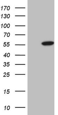 ABAT Antibody (aa29-323, clone OTI7C4)