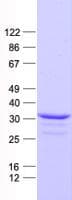Human BP1 / DLX4 Protein (Recombinant His, N-Terminal)