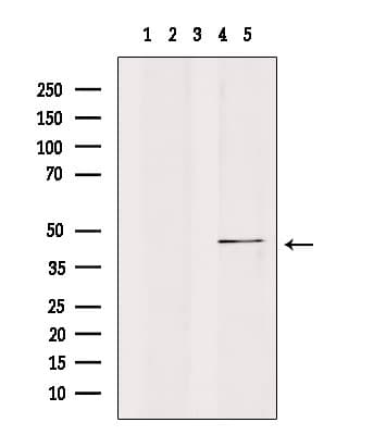 CSNK1E / CK1 Epsilon Antibody