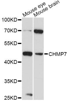 Polyclonal Rabbit anti-Human CHMP7 Antibody (WB)