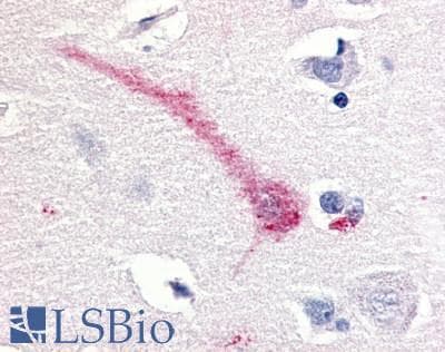 PathPlus™ MST1R / RON Antibody (C-Terminus)