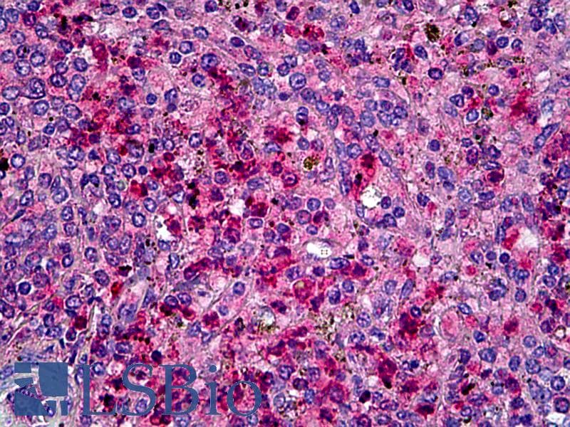 PathPlus™ Polyclonal Goat anti-Human CCR1 Antibody (N-Terminus, IHC, WB)