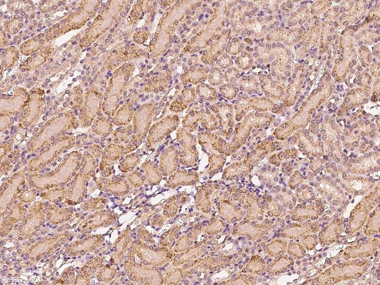 F9 / Factor IX Antibody