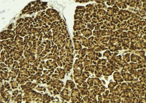 Polyclonal Rabbit anti-Human CHRAC1 Antibody (IHC, WB)
