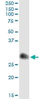 TIMP1 Antibody (clone 4D12)