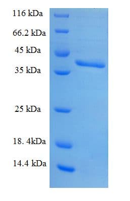 Human SNRPB2 Protein (Recombinant His-SUMO)
