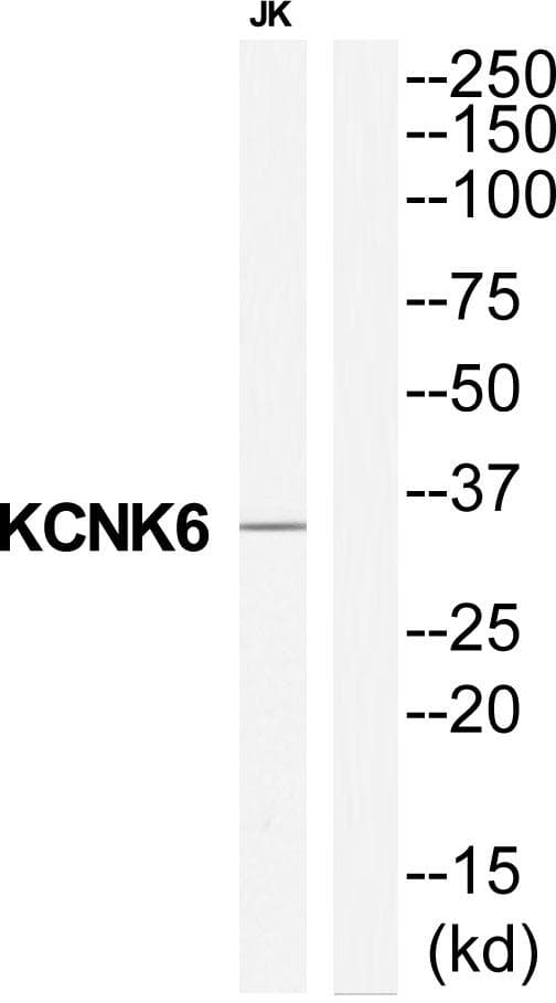 KCNK6 / TWIK-2 Antibody