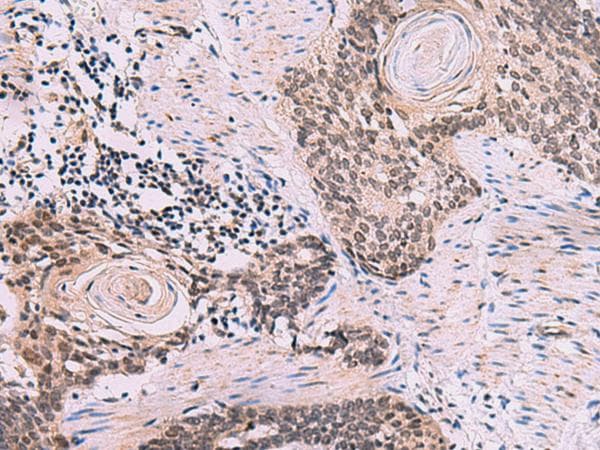 CDK4 Antibody