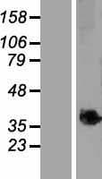 C9orf91 Protein (Over-Expression Lysate Myc-DDK (Flag))