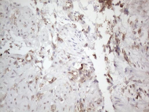 Monoclonal Mouse anti-Human PD-L2 / PDCD1LG2 / CD273 Antibody (clone OTI5E5, IHC, WB)