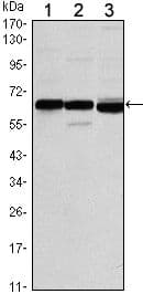 ER Alpha / Estrogen Receptor Antibody (clone 6B6)
