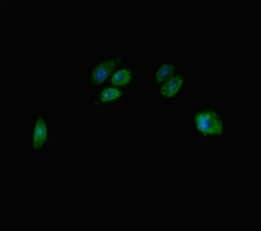 TBC1D7 Antibody