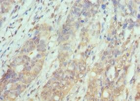 Polyclonal Rabbit anti-Human PAK1 Antibody (aa1-240, IHC)