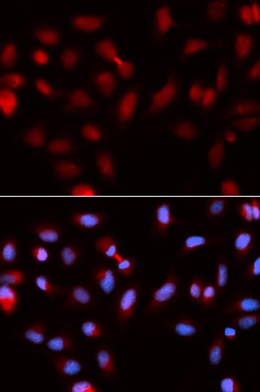 Polyclonal Rabbit anti-Human BIRC5 / Survivin Antibody (IHC, IF, WB)