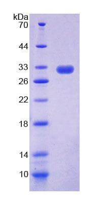 Mouse ACOX2 Protein (Recombinant His-T7, N-terminus)