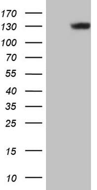Monoclonal Mouse anti-Human LAMB3 / Laminin Beta 3 Antibody (clone OTI9G3, aa22-315, WB)