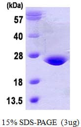 Human GPX7 Protein (Recombinant His)