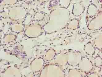 ZDHHC12 Antibody