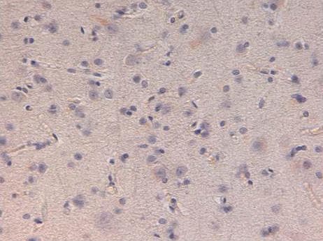 Kinesin Heavy Chain / KIF5B Antibody