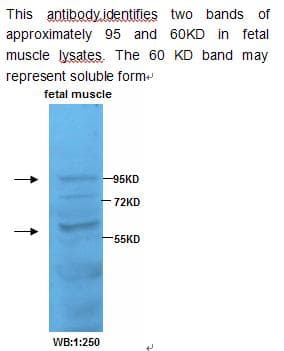 IHC-plus™ ADAM19 Antibody