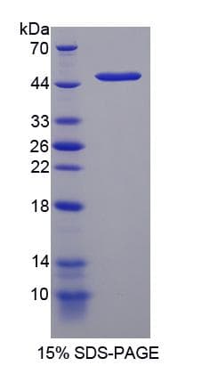Mouse DDIT3 / CHOP Protein (Recombinant His-GST)