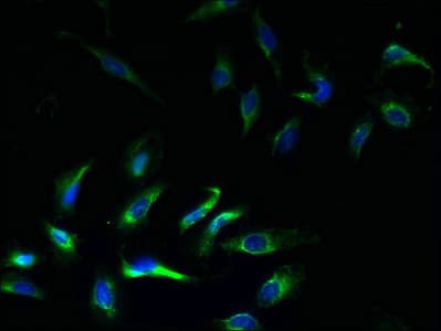 KCNJ1 / ROMK Antibody
