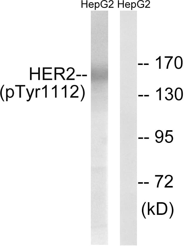 Polyclonal Rabbit anti-Human ERBB2 / HER2 Antibody (phospho-Tyr1112, WB)