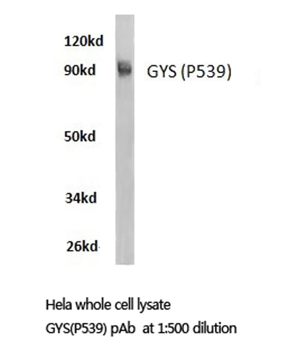 GYS1 / Glycogen Synthase Antibody (Pro539)