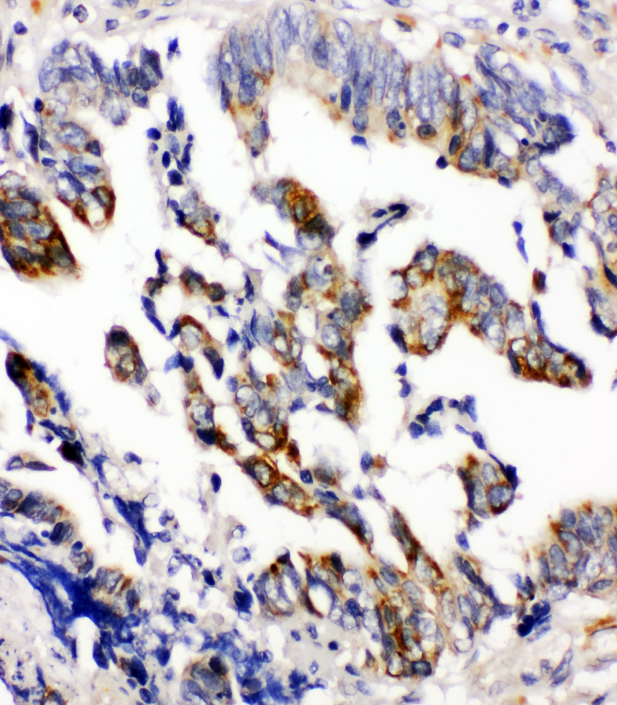 ARRB2 / Beta Arrestin 2 Antibody (aa395-409)