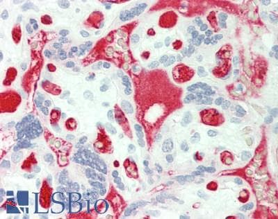 IHC-plus™ Polyclonal Rabbit anti-Human FGG / Fibrinogen Gamma Antibody (Internal, IHC, WB)