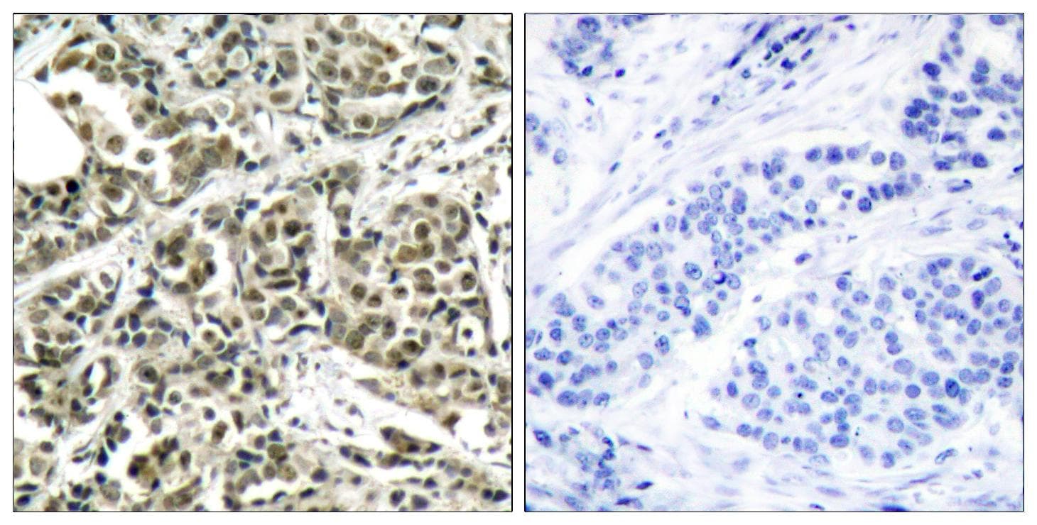 Polyclonal Rabbit anti-Human BRCA1 Antibody (aa1491-1540, IHC, WB)