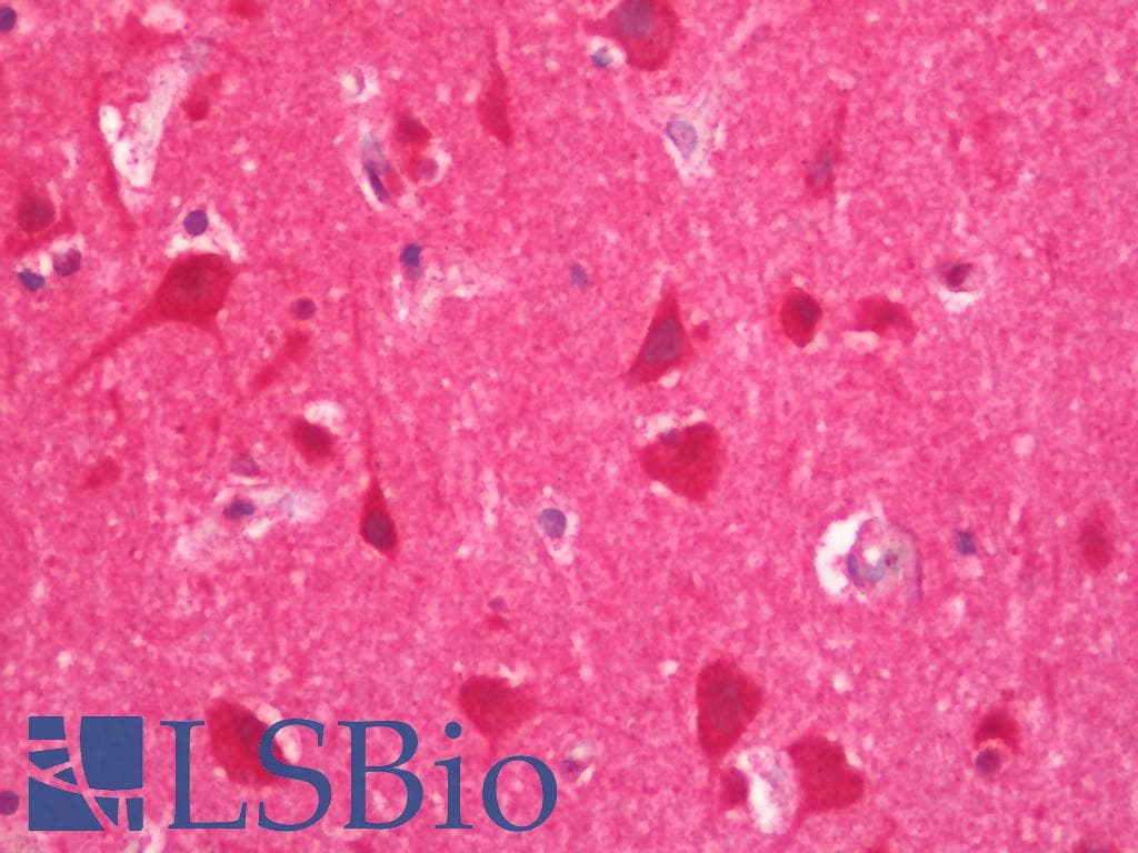 IHC-plus™ PACS1 Antibody