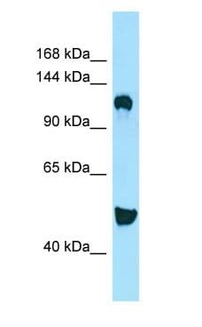DGKD Antibody (aa1066-1115)