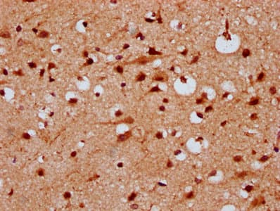 Polyclonal Rabbit anti-Human KLHL20 Antibody (IHC, IF)