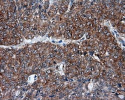 TPMT Antibody (clone OTI2A2)