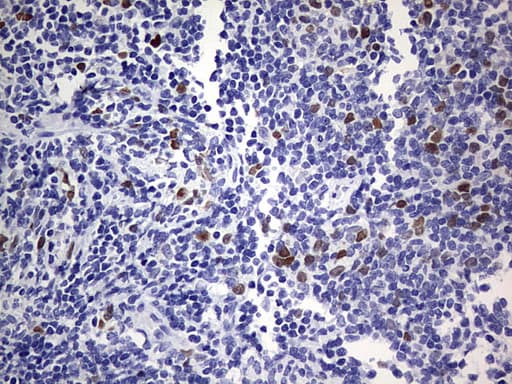 TOP2A / Topoisomerase II Alpha Antibody (aa1100-1531, clone OTI19D4)