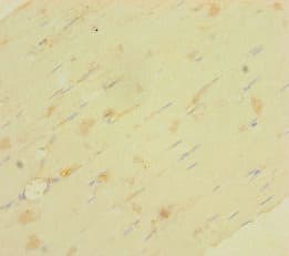 Polyclonal Rabbit anti-Human LRRC19 Antibody