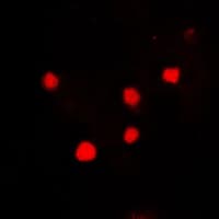 Polyclonal Rabbit anti-Human H2AFX / H2AX Antibody (C-Terminus, IHC, IF, WB)
