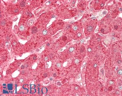 PathPlus™ HP / Haptoglobin Antibody (aa295-322)