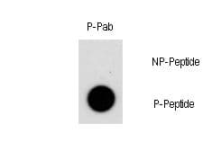 NR4A1 / NUR77 Antibody (phospho-Ser351)