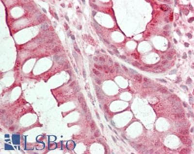 IHC-plus™ MINK1 / MINK Antibody (C-Terminus)