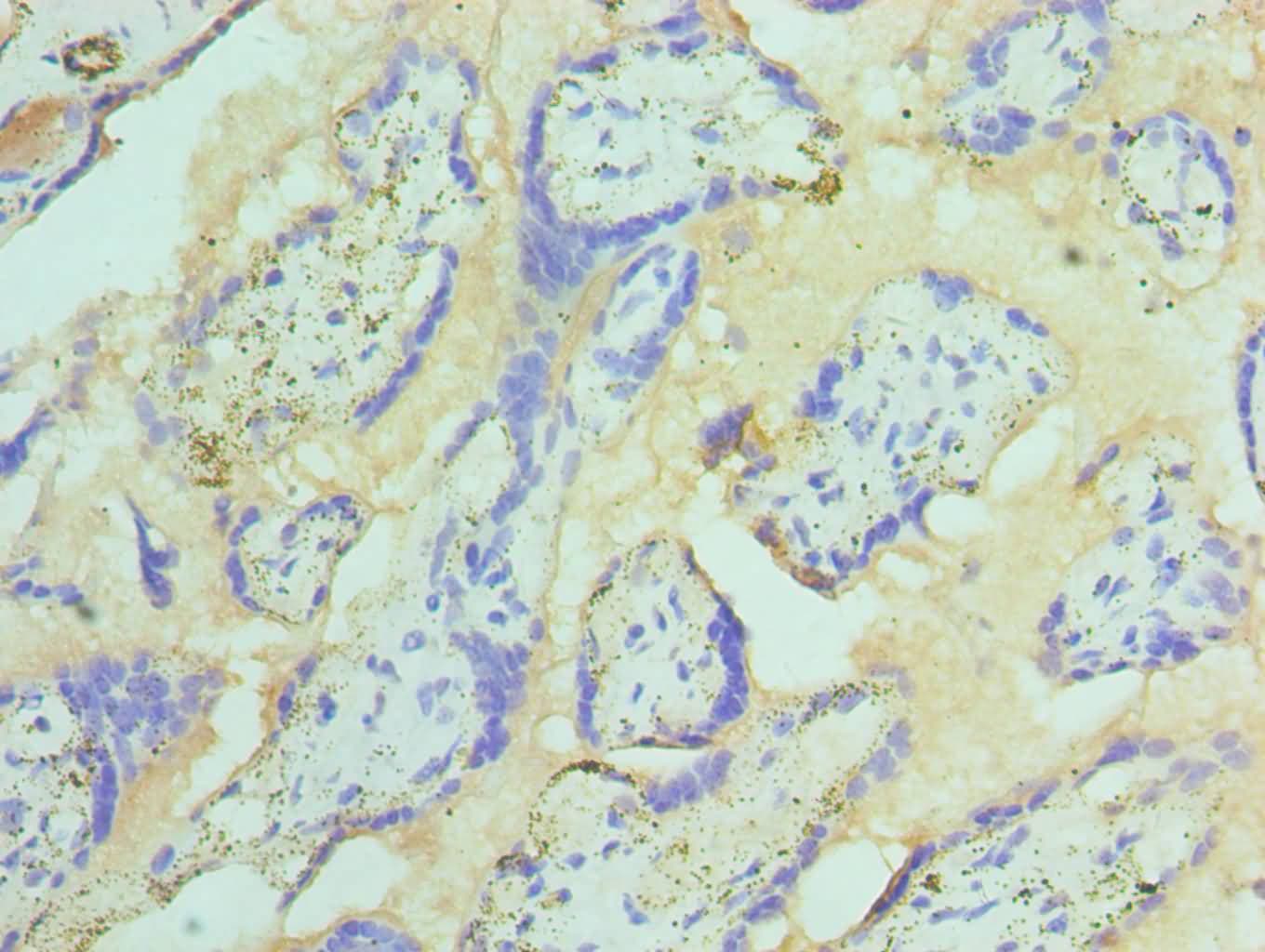 Polyclonal Rabbit anti-Human ST14 / Matriptase Antibody (aa566-855, IHC)