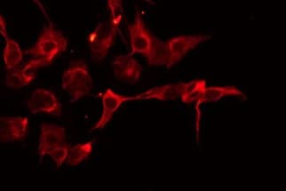 Polyclonal Rabbit anti-Human SERPINA11 Antibody (IF, WB)
